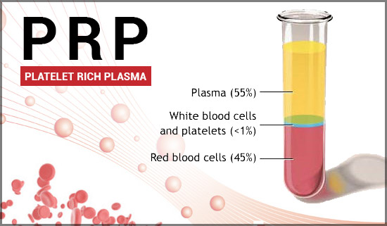 PRP Treatment in Chennai